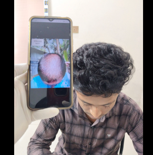 ডাক্তার আব্দুর রশিদ স্যারের চিকিৎসার আগে এবং পরের অবস্থা
