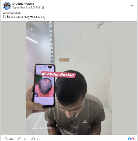 Alhamdulillah  চিকিৎসার আগে এবং পরের অবস্থা